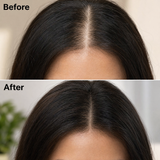 Before and after: hair parting density