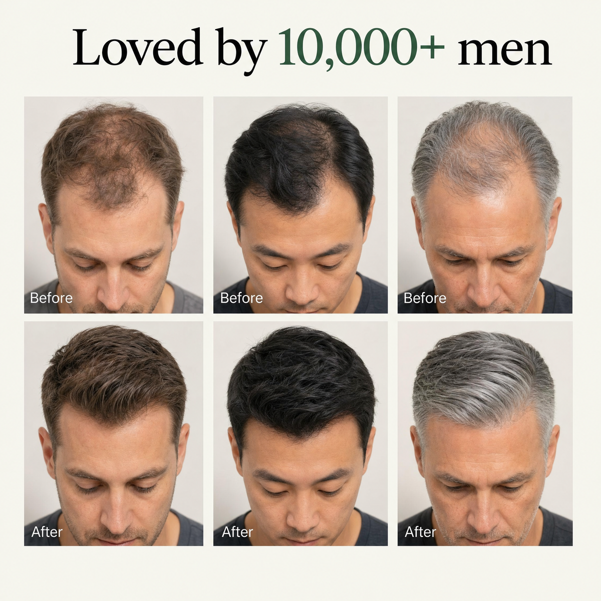 Loved by 10,000+ men — before and after