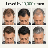 Loved by 10,000+ men — before and after