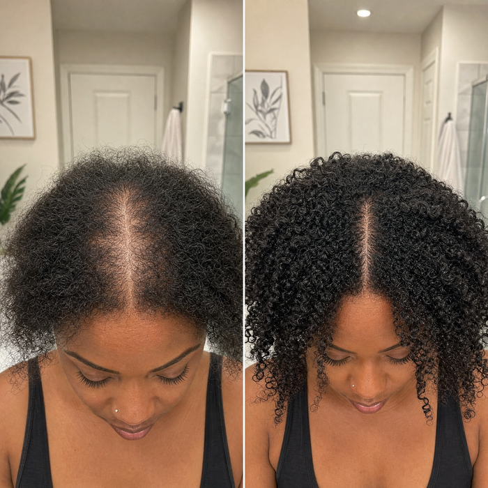 Before and after